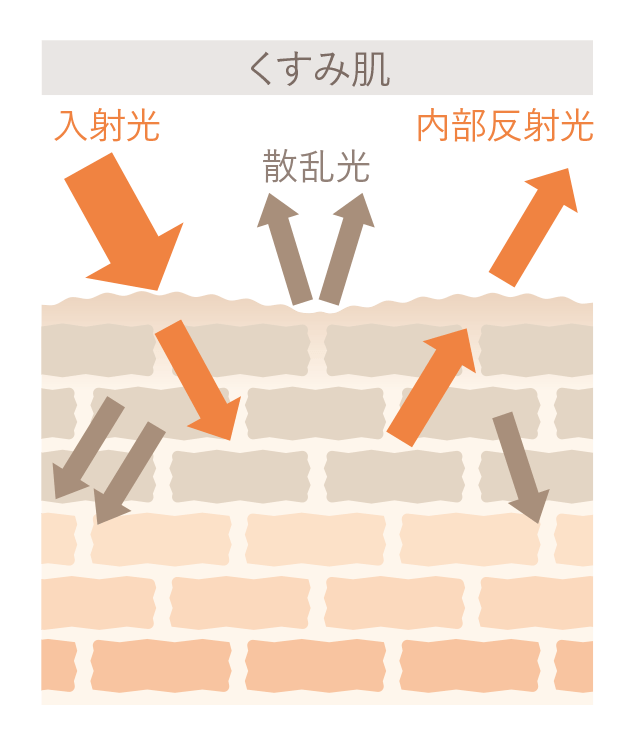 くすみ肌：キメが乱れて肌表面に凹凸があり光が反射しない