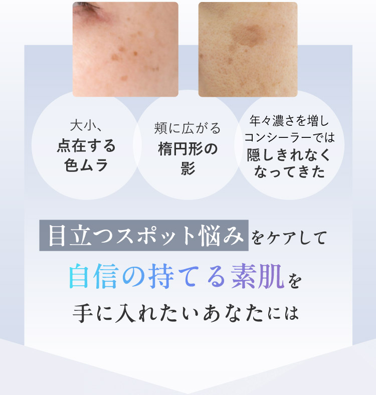 目立つスポット悩みをケアして自信の持てる素肌を手に入れたいあなたには