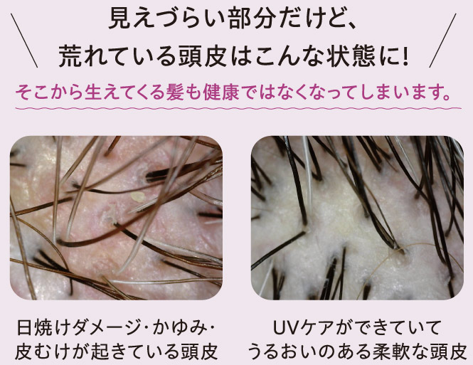 頭皮の写真
